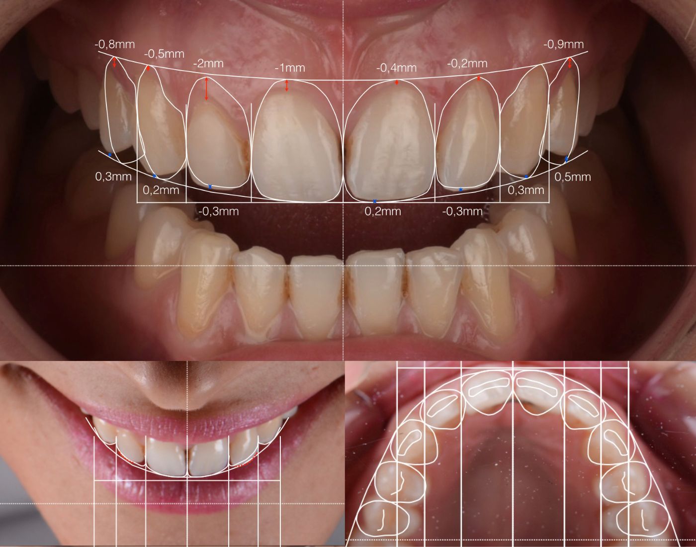 Digital Smile Design
